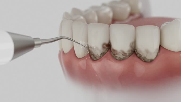 Trusted Teeth Cleaning And Checkup service in Uhrichsville, OH - Dentist Open Now